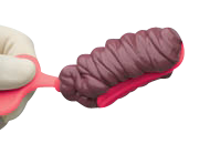 TLOC Triple Tray Anterior 28/bx. - Premier