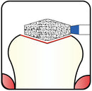 Double Conical, Symmetrical, Short 3.5 mm Dia. Fine Grit Diamond Bur 5 per pack. 037.35F1