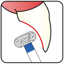 Wheel 4.2 mm Dia.  Medium Grit Diamond Bur 5 per pack. 068.42M1