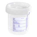 Tube, Coll Urine Str 60Mmx65Mmw/Click Cap & Label (400/Cs), Sold As 400/Case Sarstedt 75.1435.004