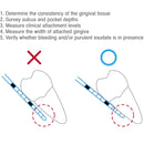 12N Dental Probe Metal handle Osung -BPCP12N