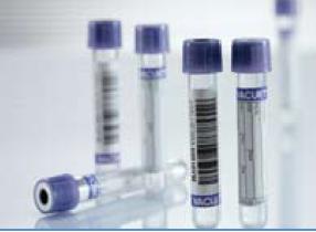 VACUETTE® VENOUS BLOOD COLLECTION TUBE, 4 ML, 13 X 75 MM, SOLD AS 50/PACK GREINER 454209