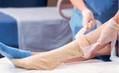 Alba Sterile Orthopedic Stockinette Stockinette Dbl-Ply 6X48120Rl/Cs -87664