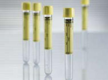 VACUETTE® URINALYSIS TUBE, 9 ML, 16 X 100 MM, SOLD AS 50/BOX GREINER 455028