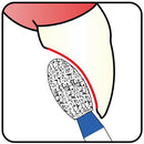 Egg 2.3 mm Dia. Medium Grit Diamond Bur 5 per pack. 277.23M1