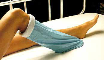 Alba Sterile Stockinette Stockinette Impervious Stwht/Blu 7X48 20/Cs -85507