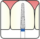 Torpedo, Conical 1.8 mm Dia. Extra Coarse Grit Diamond Bur 5 per pack. 294.18EC3