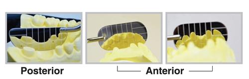 Dental Mirror Set, Parallel, 2 pcs, DMPRSET - Osung USA