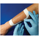 TRANSPARENT DRESSING, 4" X 4¾", 40/PK, 4 PK/CS, SOLD AS CASE AMD-MEDICOM 10000212