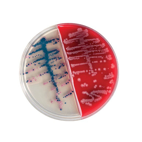 BBL™ COLUMBIA CNA AGAR PLATE, WITH 5% SHEEP BLOOD, 100/PK, SOLD AS PACK BD 209