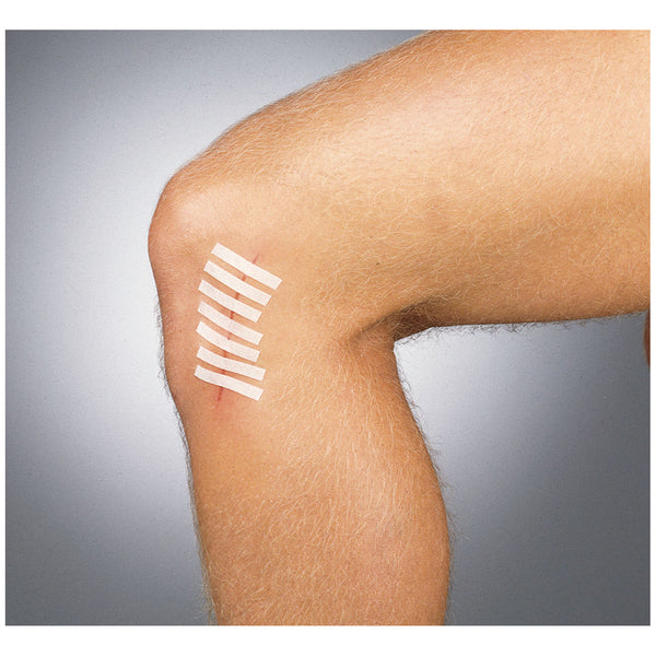 WOUND CLOSURE STRIP, ¼" X 1½", 6/POUCH, 50 PCH/BX, SOLD AS BOX GENTELL 10001352