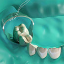 LOWER LEFT PRIMARY 1ST