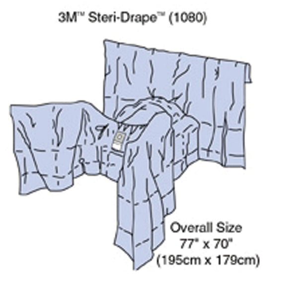 STERI-DRAPE™ LAPAROSCOPY DRAPE, 95", LITHOTOMY POSITION, ABSORBENT IMPERVIOUS MATERIAL, ADHESIVE APERTURE, PERINEAL/ VAGINAL APERT, SOLD AS CASE SOLVE