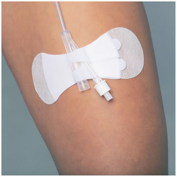 SECUREMENT DEVICE, PEDIATRIC FOLEY CATHETER, STERILE, INDIVIDUALLY PACKAGED, 100/BX, SOLD AS BOX TIDI 203