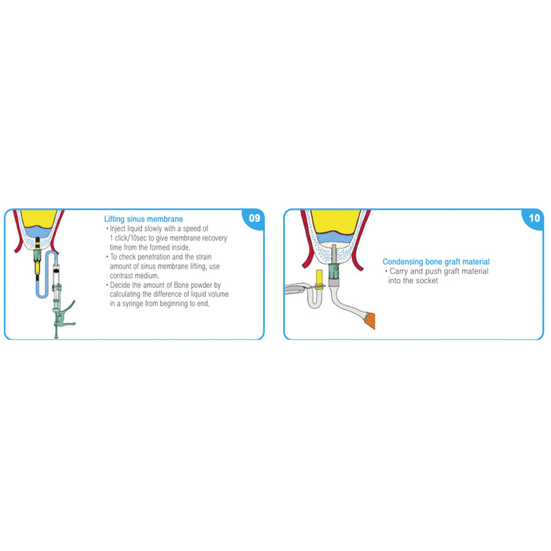 Sinus Lift Crestal Approach Kit with Aqua Lift Osung -OCA-KIT