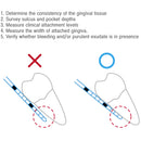 Osung GF-W Goldman-Fox + Williams Dental Probe Premium -BPGF-W - Osung USA