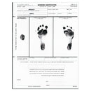 DISPOSABLE FOOT PRINTER, 25/BX, SOLD AS BOX PRECISION 10001102