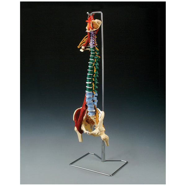 MUSCLED SPINE MODEL WITH DISORDERS, STAND INCLUDED, SOLD AS EACH ANATOMICAL 10000765
