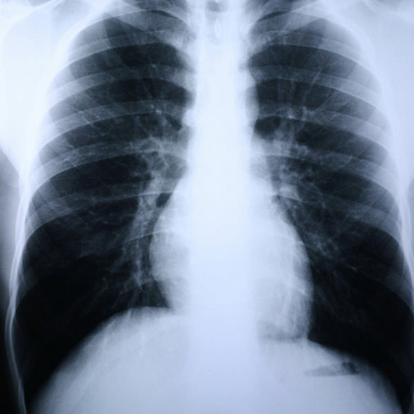 CLEAR CHOICE™ PERFORMANCE X-RAY FILM, SOLD AS 100/BOX MCKESSON 55BN7
