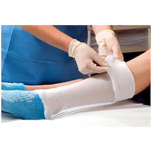 Alba Sterile Stockinette Stockinette Synthetic Dbl-Ply4X60 Wht 18/Cs -C8545