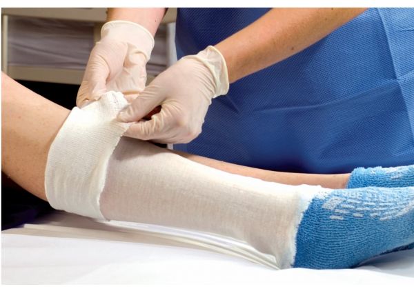 Alba Non-Sterile Stockinette Stockinette Bias Ns 12Ft4X50Yds 100/Cs -95444