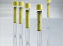 Vacuette® Urinalysis Tube, 6 mL, 13 x 100 mm, 1200/CS
