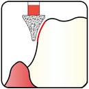 Conical, Concave Side 3.1 mm Dia. Fine Grit Diamond Bur 5 per pack. 466.31F1 - Osung USA
