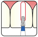 Conical, Round Edge 1.6 mm Dia. Fine Grit Diamond Bur 5 per pack. 584.16F3