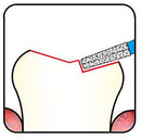 Conical, Round Edge 2.5 mm Dia. Fine Grit Diamond Bur 5 per pack. 584.25F1