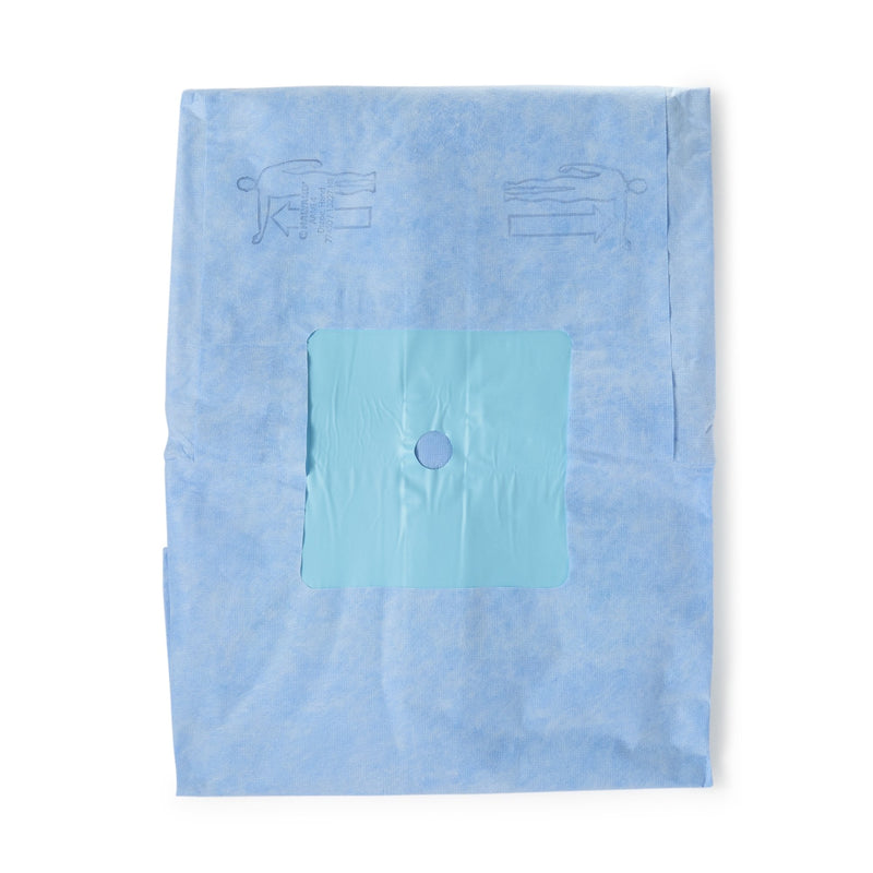 Halyard Sterile Hand Orthopedic Drape, 114 x 142 Inch 1/EACH -77450