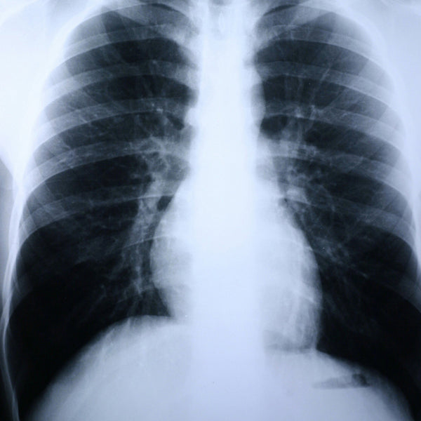 CLEAR CHOICE™ PERFORMANCE X-RAY FILM, SOLD AS 100/BOX MCKESSON XDAMC