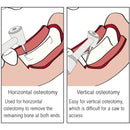 Osung Ridge Split Bur 10mm -RSBTRM - Osung USA