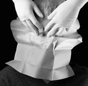 SMALL DRAPE WITH ADHESIVE APERTURE, 15" X 15", 10/BX, 4 BX/CS, SOLD AS CASE SOLVENTUM 1