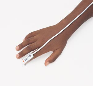 MEDTRONIC OXIMAX®/OXISENSOR® II ADHESIVE SENSORS, SOLD AS CASE MEDTRONIC/MINIMALLY 10000398