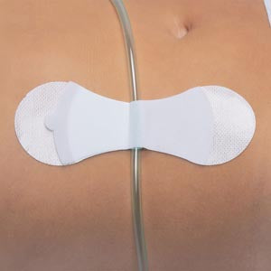 Tidi Grip-Lok Universal Securement Device. Device Lg Univ St 100/Bx, Box