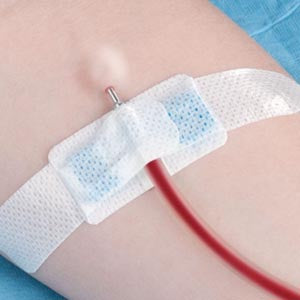 SECUREMENT DEVICE, EPIDURAL CATHETER, MEDIUM, STERILE, INDIVIDUALLY PACKAGED, 50/BX, SOLD AS BOX TIDI 203